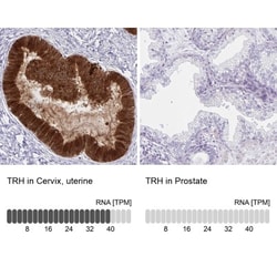 Thyrotropin Releasing Hormone Antibody, Novus Biologicals 25 &mu;L, Unlabeled:Antibodies,